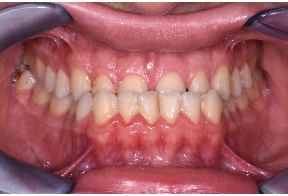 Ortodonzia e chirurgia
