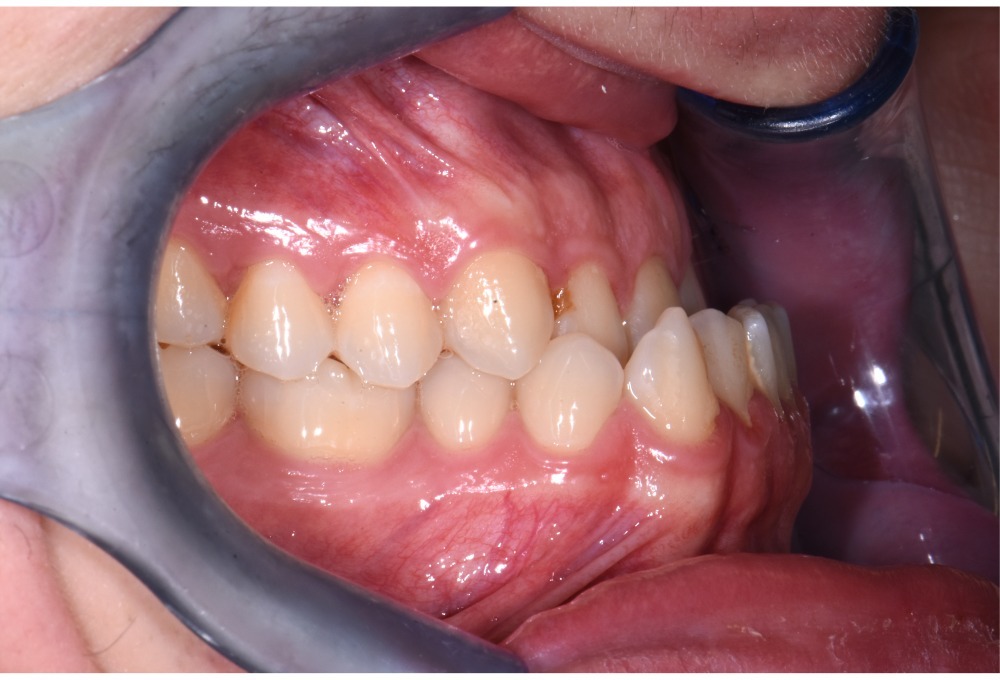 Ortodonzia e chirurgia